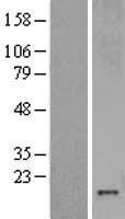 MT3 Human Over-expression Lysate