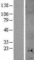 MT1H Human Over-expression Lysate
