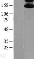 ASK1 (MAP3K5) Human Over-expression Lysate