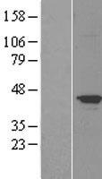 Tau (MAPT) Human Over-expression Lysate