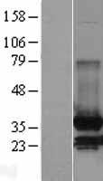 MDH2 Human Over-expression Lysate