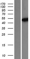 Isocitrate dehydrogenase (IDH1) Human Over-expression Lysate