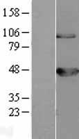 BCKDH kinase (BCKDK) Human Over-expression Lysate