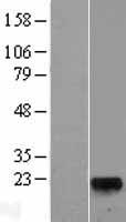 GLYAT Human Over-expression Lysate