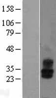 KCNMB2 Human Over-expression Lysate