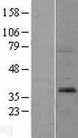 Sprouty 2 (SPRY2) Human Over-expression Lysate