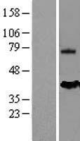 Mesothelin (MSLN) Human Over-expression Lysate