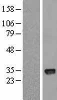 CTDSPL Human Over-expression Lysate