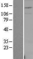 USPL1 Human Over-expression Lysate