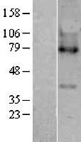 LPCAT3 Human Over-expression Lysate