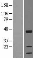 TOB (TOB1) Human Over-expression Lysate