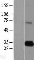 Elastase 3A (CELA3A) Human Over-expression Lysate