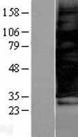 SCAMP3 Human Over-expression Lysate