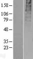 GPR55 Human Over-expression Lysate