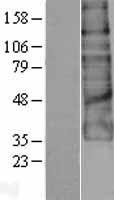 GPR56 (ADGRG1) Human Over-expression Lysate