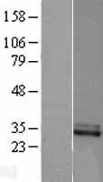 CFHL2 (CFHR2) Human Over-expression Lysate