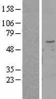 TMPRSS2 Human Over-expression Lysate