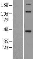 TDO2 Human Over-expression Lysate