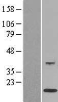 S100A12 Human Over-expression Lysate