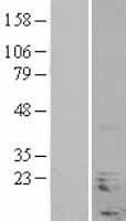 NHLH1 Human Over-expression Lysate
