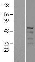 Cytokeratin 7 (KRT7) Human Over-expression Lysate