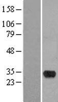 HMX2 Human Over-expression Lysate