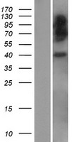 HLAE (HLA-E) Human Over-expression Lysate