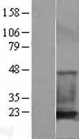 Cofilin 1 (CFL1) Human Over-expression Lysate