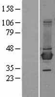 BCAT1 Human Over-expression Lysate