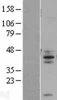 FAIM3 (FCMR) Human Over-expression Lysate