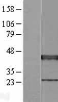 XRCC3 Human Over-expression Lysate