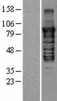 PKC epsilon (PRKCE) Human Over-expression Lysate