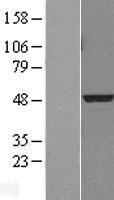 PDK3 Human Over-expression Lysate