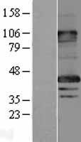 MAGEA8 Human Over-expression Lysate