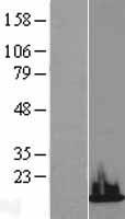 H3.3B (H3F3B) Human Over-expression Lysate