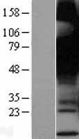 GPR12 Human Over-expression Lysate