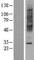 NPBWR2 Human Over-expression Lysate