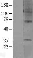 GPR6 Human Over-expression Lysate