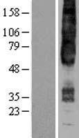 GPR4 Human Over-expression Lysate