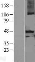 Myostatin Propeptide (MSTN) Human Over-expression Lysate