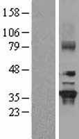 GNB2 Human Over-expression Lysate