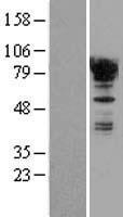 EWSR1 Human Over-expression Lysate