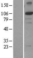 XPF (ERCC4) Human Over-expression Lysate