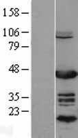 NR2F6 Human Over-expression Lysate