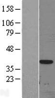 DLX3 Human Over-expression Lysate
