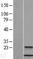Cystatin A (CSTA) Human Over-expression Lysate