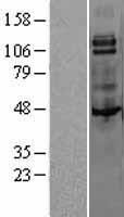 MCSF Receptor (CSF1R) Human Over-expression Lysate