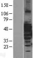 MAP3K8 Human Over-expression Lysate