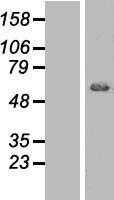 AKT1 Human Over-expression Lysate