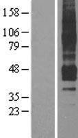 APJ Receptor (APLNR) Human Over-expression Lysate